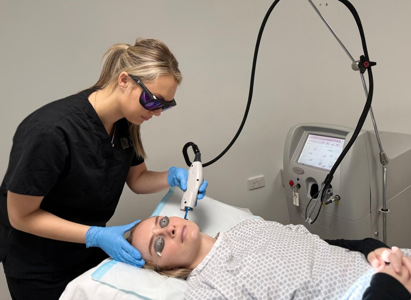 Vbeam® laser treatment at Scars & Lasers