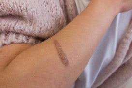 Skin Pigment Alteration